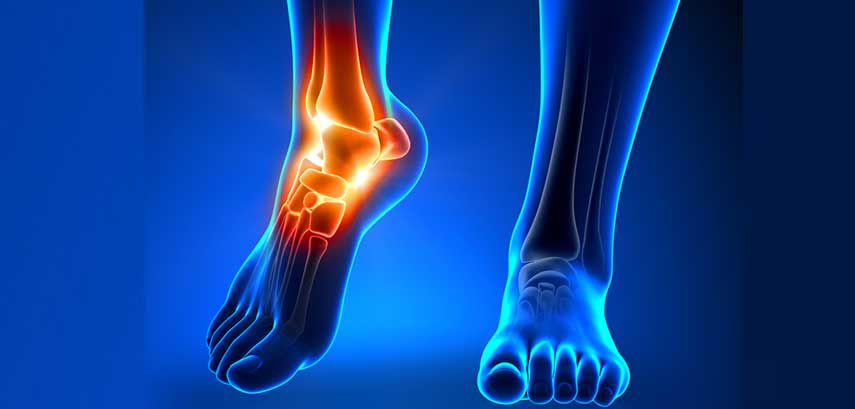 Foot-&-Ankle-Surgery-Canyon-Speciality-Surgery-Center-1