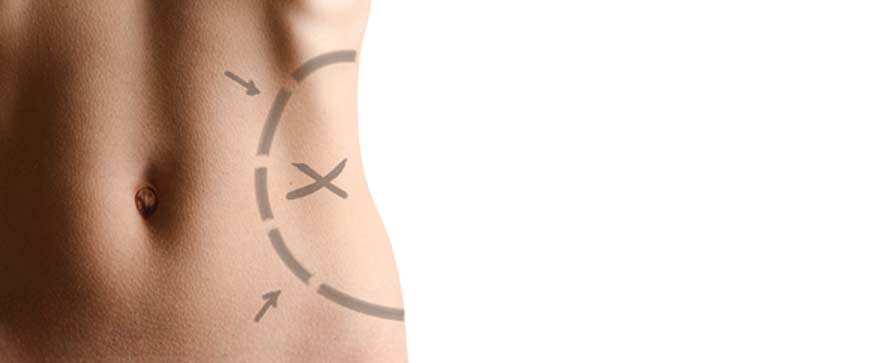 Liposuction - Canyon Speciality Surgery Center