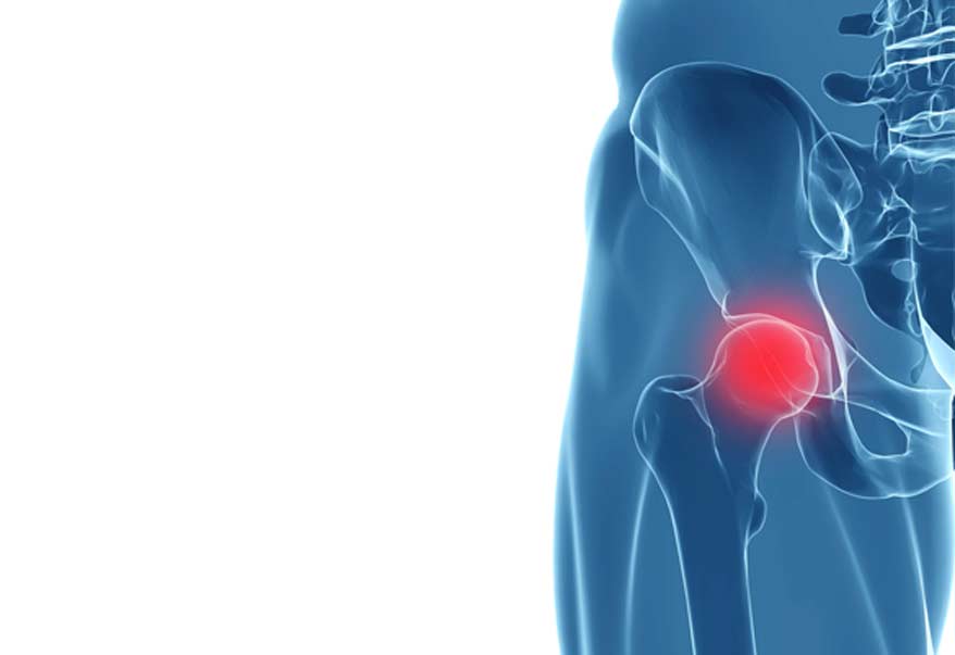 Outpatient Minimally Invasive Total Hip Replacement - Canyon Speciality Surgery Center
