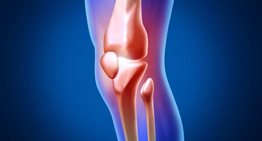 Outpatient Minimally Invasive Total Knee Replacement - Canyon Speciality Surgery Center