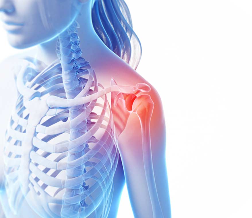 Rotator Cuff Repair - Canyon Speciality Surgery Center