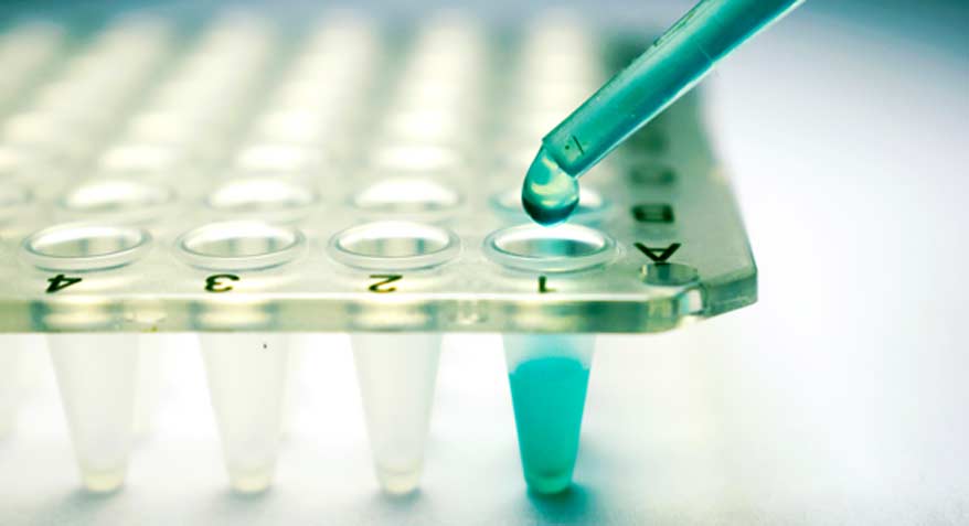 Stem Cell Therapy - Canyon Speciality Surgery Center Stem Cell Therapy - Canyon Speciality Surgery Center