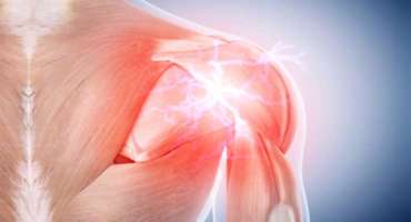 Rotator-Cuff-Repair-Canyon-Speciality-Surgery-Center