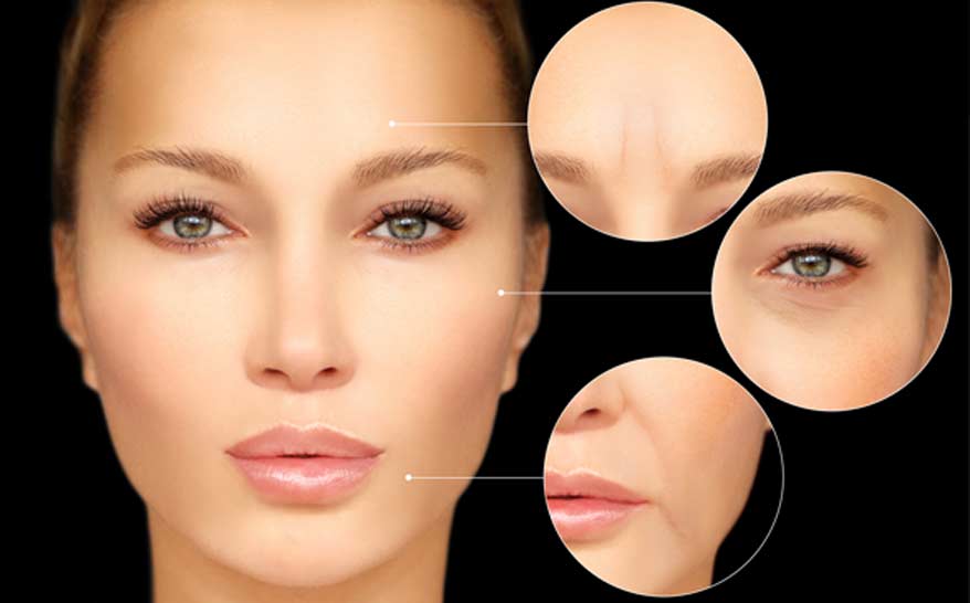 Botox - Canyon Speciality Surgery Center Botox - Canyon Speciality Surgery Center