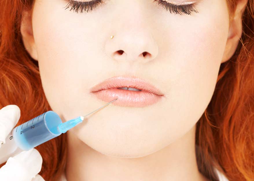 Restylane - Canyon Speciality Surgery Center Restylane - Canyon Speciality Surgery Center