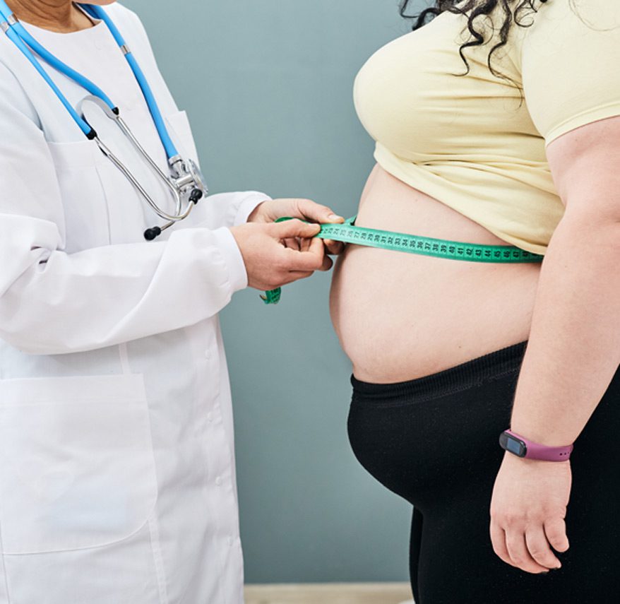 Obese-patient-being-measured-by-physician